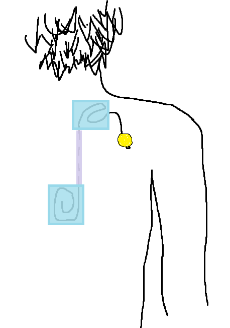 catheter protection.png